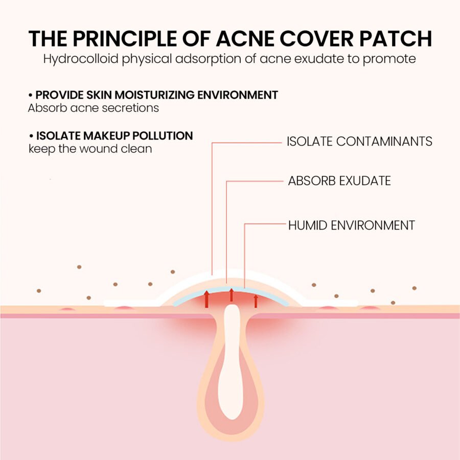 Pimple Patches,Pimple Patches For Face, Hydrocolloid Acne Patches, Cute Star Stickers Hydrocolloid Acne Pimple Patch For Covering Zits And Blemishes