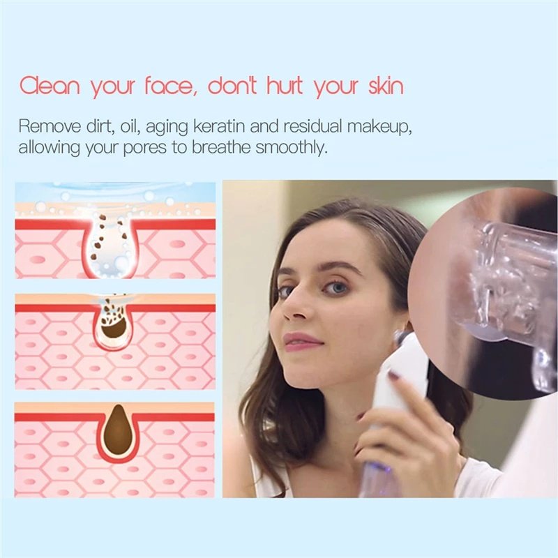 3-Color LED Blackhead Pore Vacuum